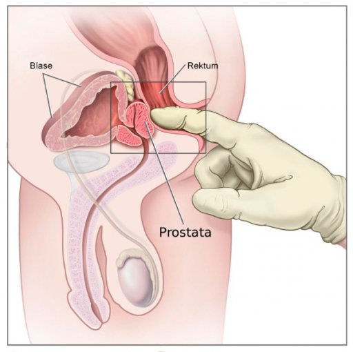 Anleitung Prostatamassage