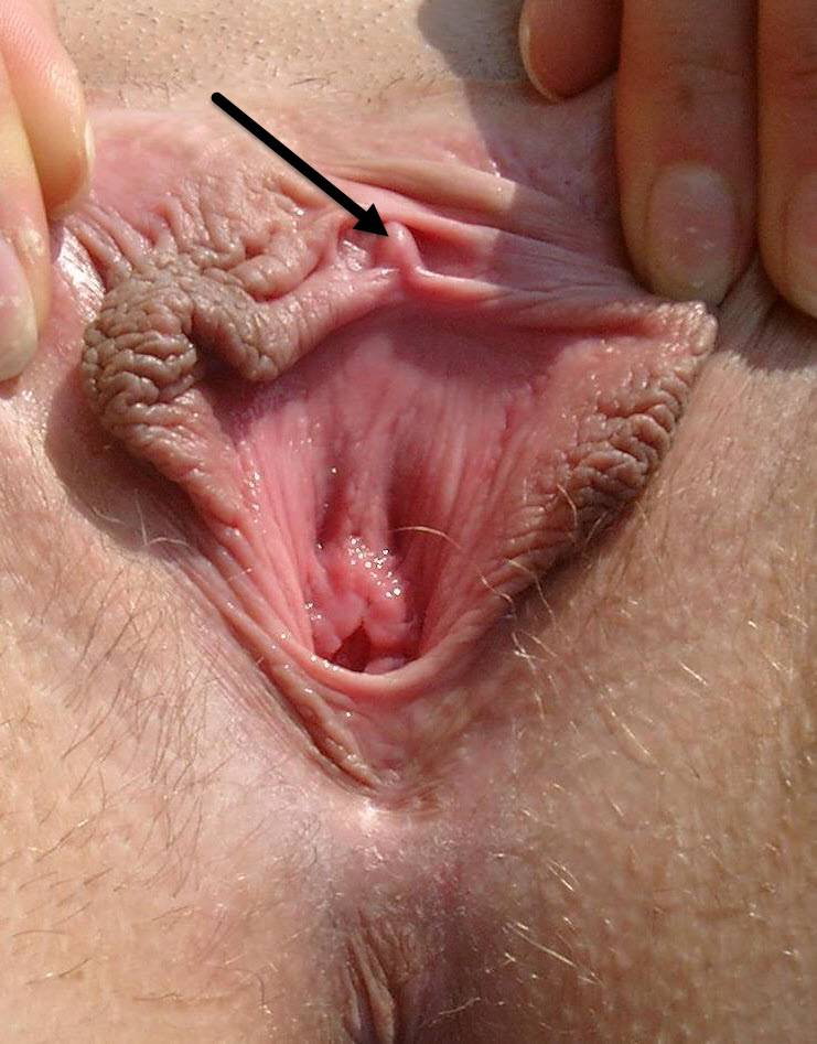 Schöne klitoris
